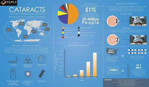 How Technology Is Changing the Way We Treat Cataracts