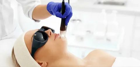 CO2 Laser Treatment in The Woodlands: A Modern Solution for Skin Rejuvenation