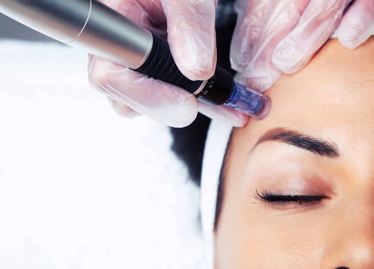 How Medical Aesthetics Can Treat More Than Wrinkles: Migraines, Sweat, and Jaw Clenching